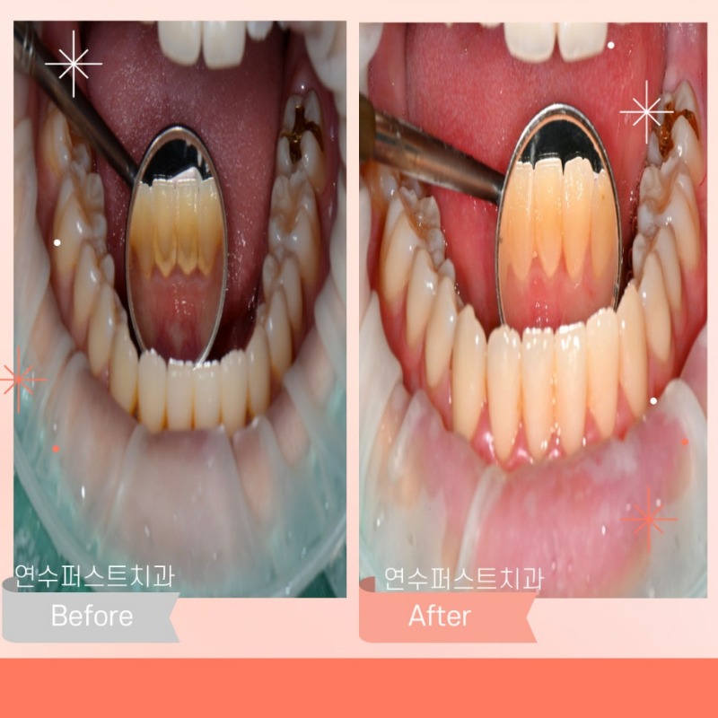 에어플로 4.jpg