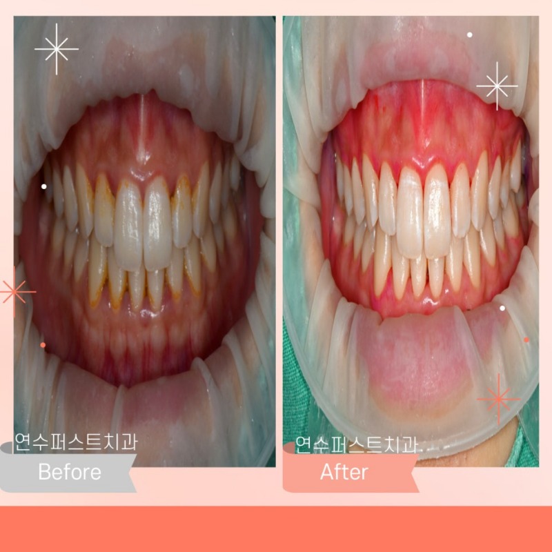 에어플로 3.jpg
