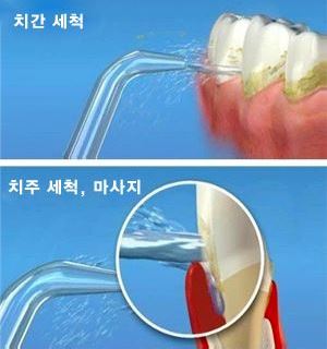 워터픽2.jpg