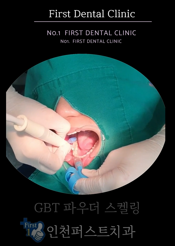 안아픈스켈링3.PNG