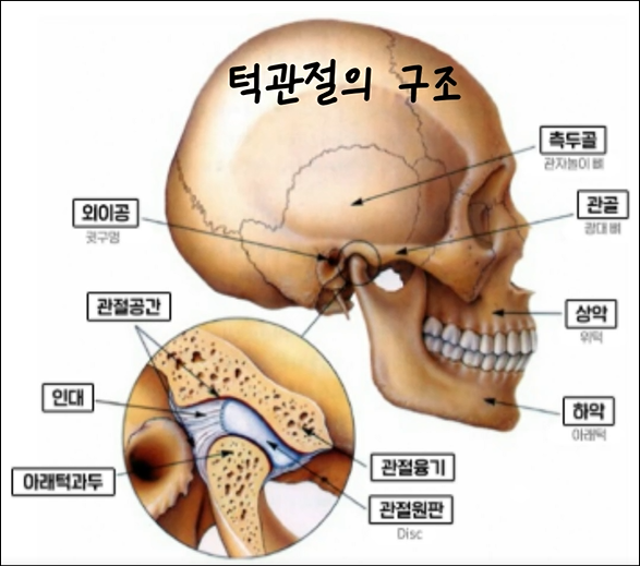 턱관절1.PNG