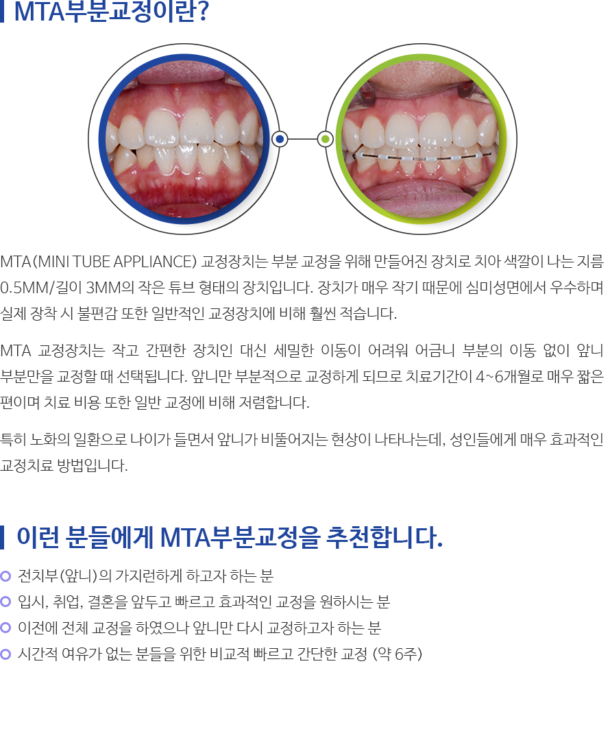 인천퍼스트치과 서브컨텐츠 내용