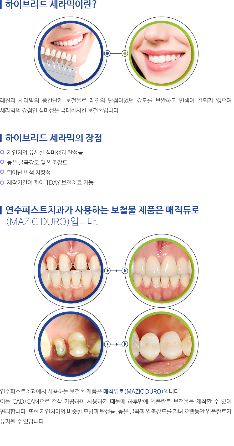인천퍼스트치과 서브컨텐츠 내용