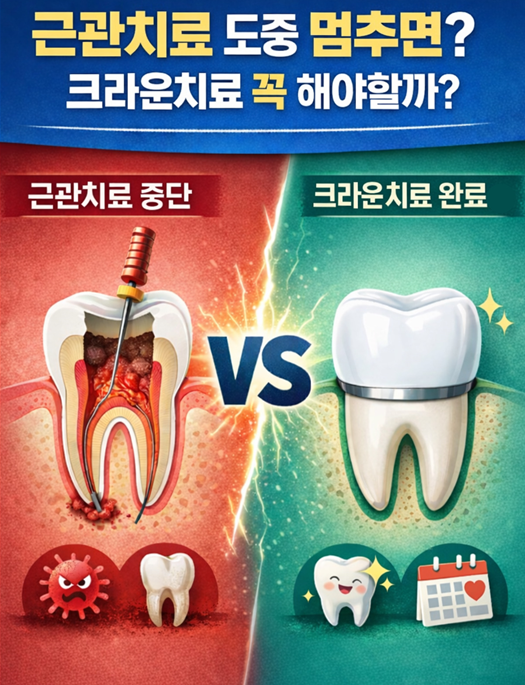 근관1.png