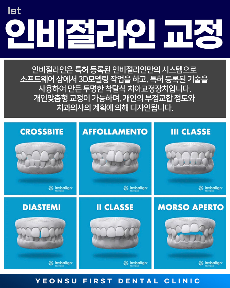 3인비절라인.jpg